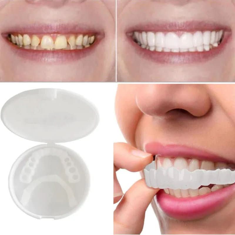 Customizable Dental Veneers Snap-On Teeth Whitening Solution - Product detail 4