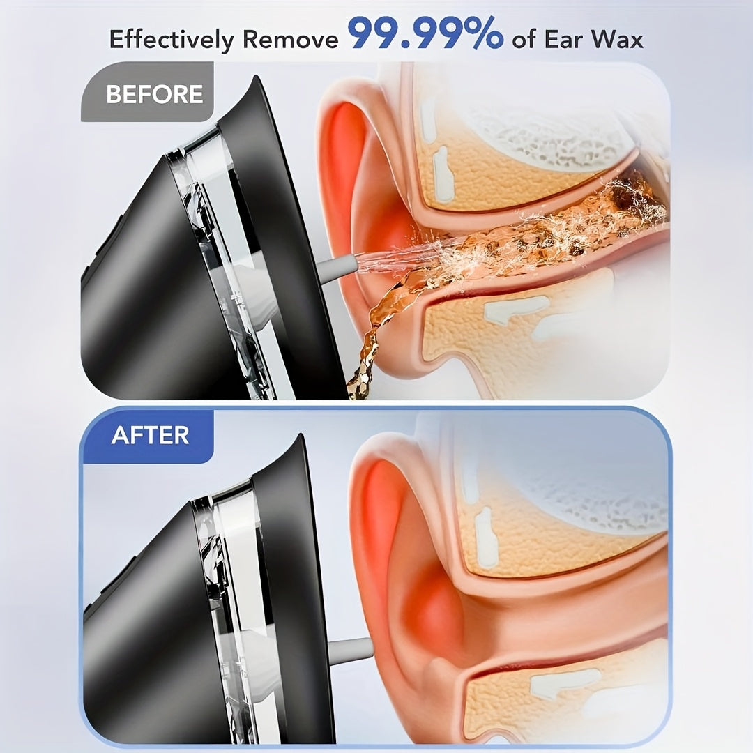 Electric Ear Cleaner with Three Speed Water Pressure and Rechargeable Battery