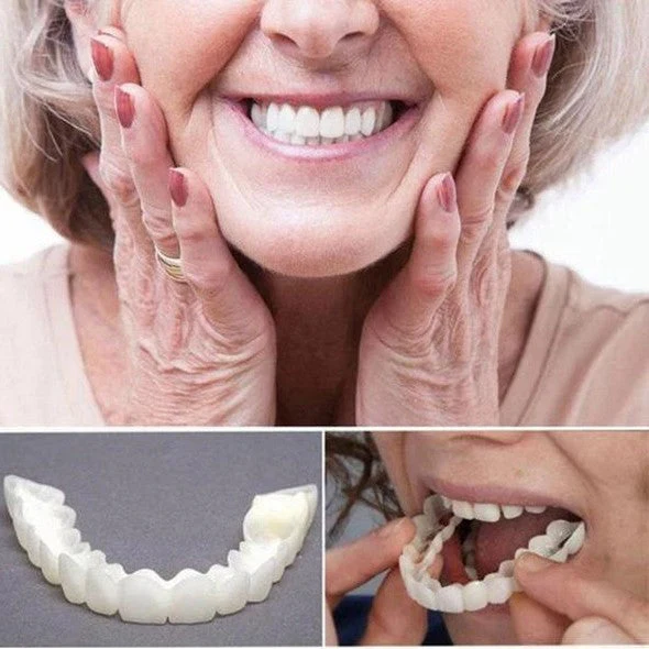 On Smile Veneers Upper and Lower Teeth Set