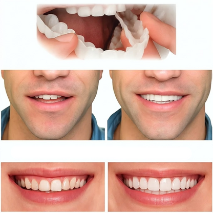 Snap-On Smile Cover Adjustable Fit Natural White