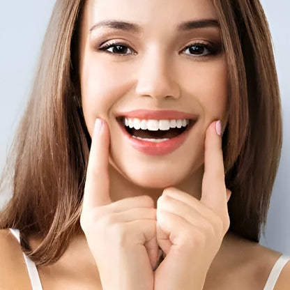 On Smile Veneers Upper and Lower Teeth Set