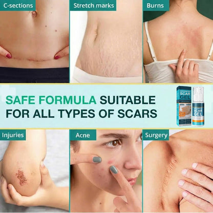 Silicone Scar Gel Moisturizing Cream for Skin Marks and Stretch Marks
