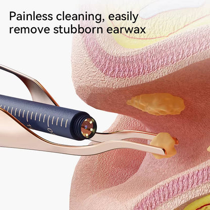 Visual Ear Cleaning Tool with HD Camera Video and Storage Case