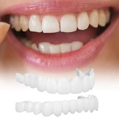 Snap-On Temporary Tooth Veneer Cover Set, 2 Piece