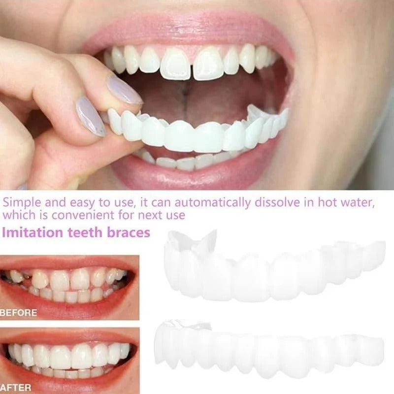 Snap-On Temporary Tooth Veneer Cover Set, 2 Piece