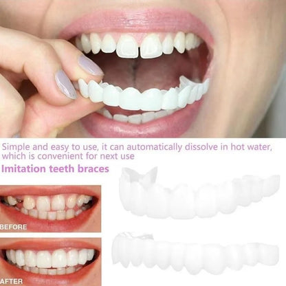 Snap-On Temporary Tooth Veneer Cover Set, 2 Piece