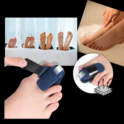 Flexible Toe Alignment Support Brace with Adjustable Support Bars for Daily Shoe Wear