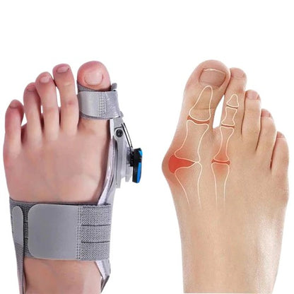 Toe Alignment Support Device with Adjustable Knob Design