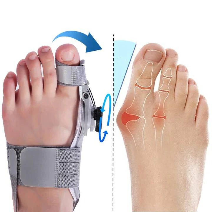 Toe Alignment Support Device with Adjustable Knob Design