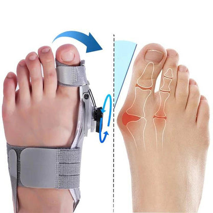 Toe Alignment Support Device with Adjustable Knob Design