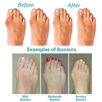 Orthopedic Comfort Sandals with Arch Support and Toe Separator
