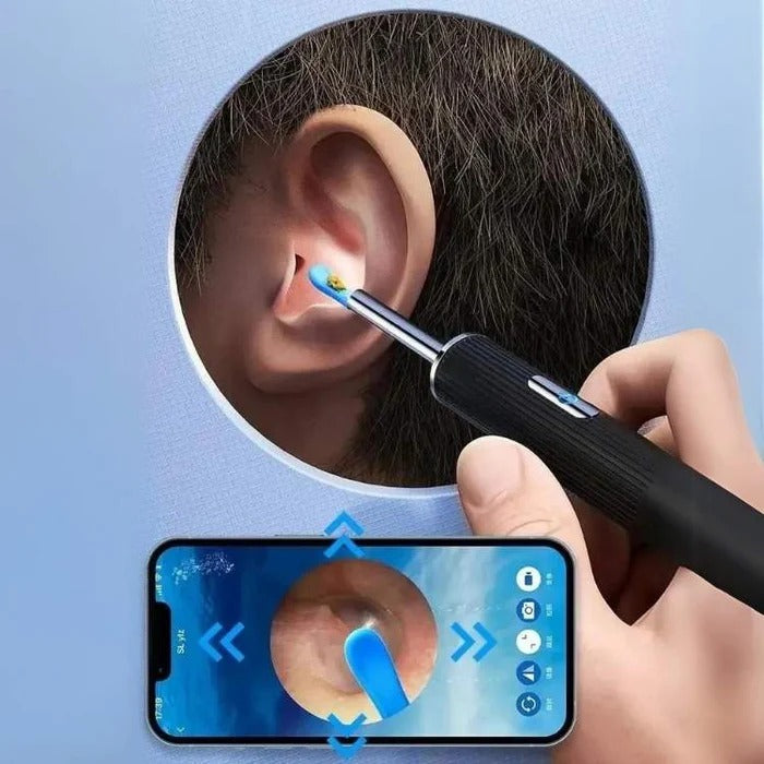 Rechargeable Ear Cleaning Tool with Camera View