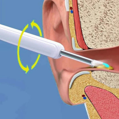 Rechargeable Ear Cleaning Tool with Camera View