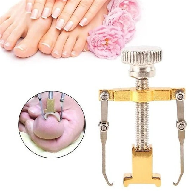 2 Piece Toenail Correction Clip Set with Stainless Steel Straightening Tool for Nail Care