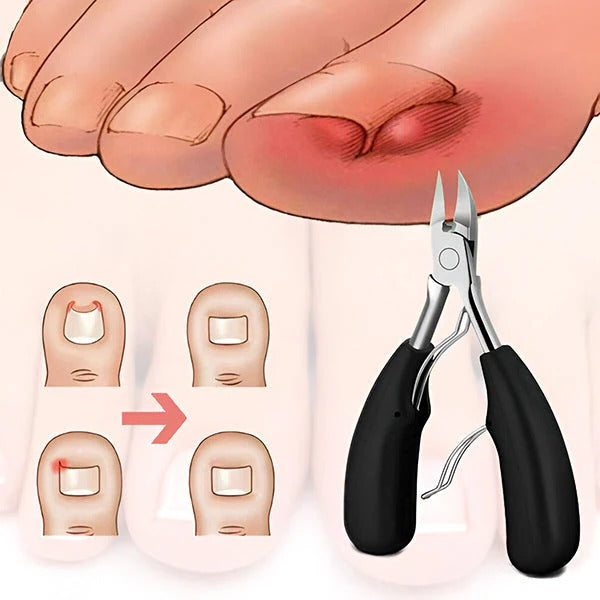 Stainless Steel Nail Grooming Kit for Hands and Feet