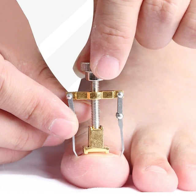 2 Piece Toenail Correction Clip Set with Stainless Steel Straightening Tool for Nail Care