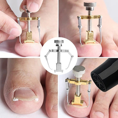 2 Piece Toenail Correction Clip Set with Stainless Steel Straightening Tool for Nail Care