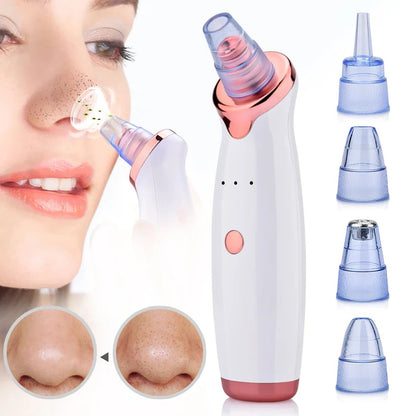 Electric Facial Pore Vacuum with Rechargeable Suction and Cleaning Tip