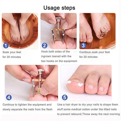 2 Piece Toenail Correction Clip Set with Stainless Steel Straightening Tool for Nail Care