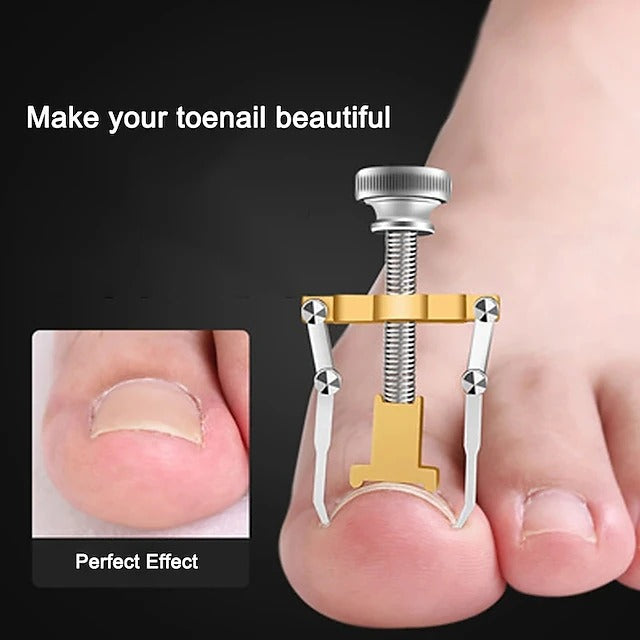 2 Piece Toenail Correction Clip Set with Stainless Steel Straightening Tool for Nail Care