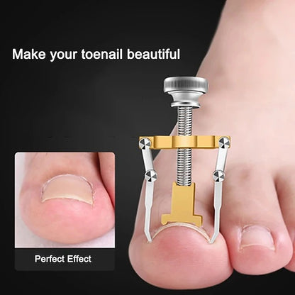 2 Piece Toenail Correction Clip Set with Stainless Steel Straightening Tool for Nail Care