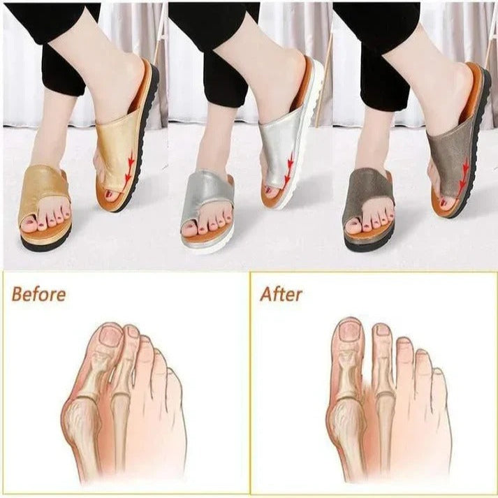 Orthopedic Platform Sandals with Spacious Toe Design