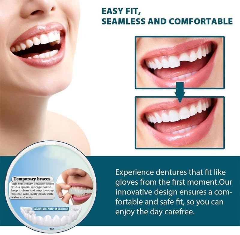 Reusable Temporary Smile Veneer Top and Bottom Set