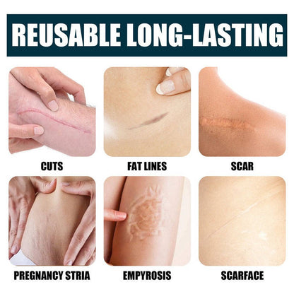 Silicone Scar Gel Moisturizing Cream for Skin Marks and Stretch Marks