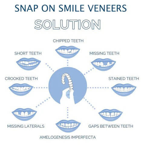 Reusable Temporary Smile Veneer Top and Bottom Set