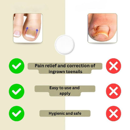 Instant Nail Repair Corrector for Ingrown and Damaged Nails