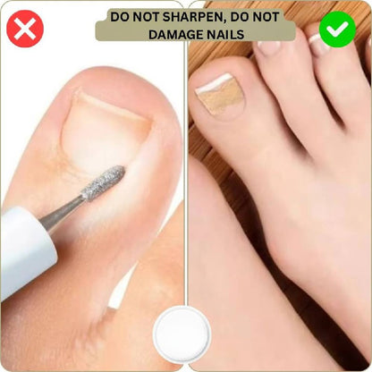 Instant Nail Repair Corrector for Ingrown and Damaged Nails