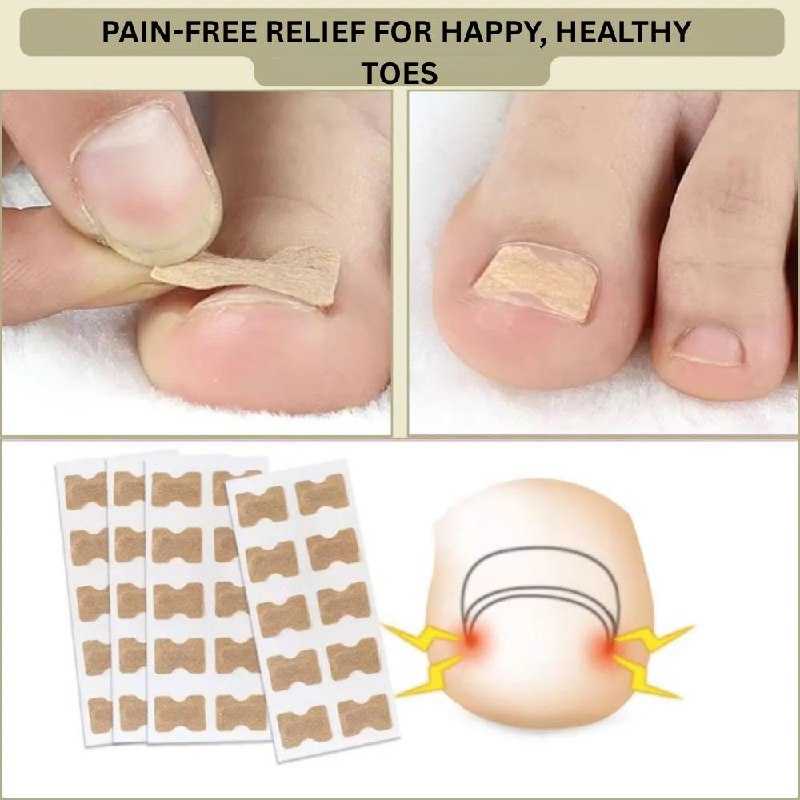 Instant Nail Repair Corrector for Ingrown and Damaged Nails