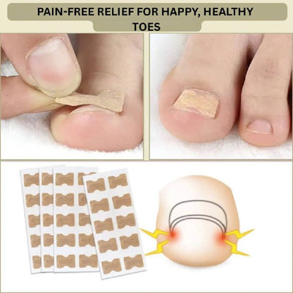 Instant Nail Repair Corrector for Ingrown and Damaged Nails