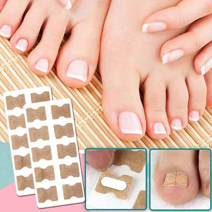 Instant Nail Repair Corrector for Ingrown and Damaged Nails