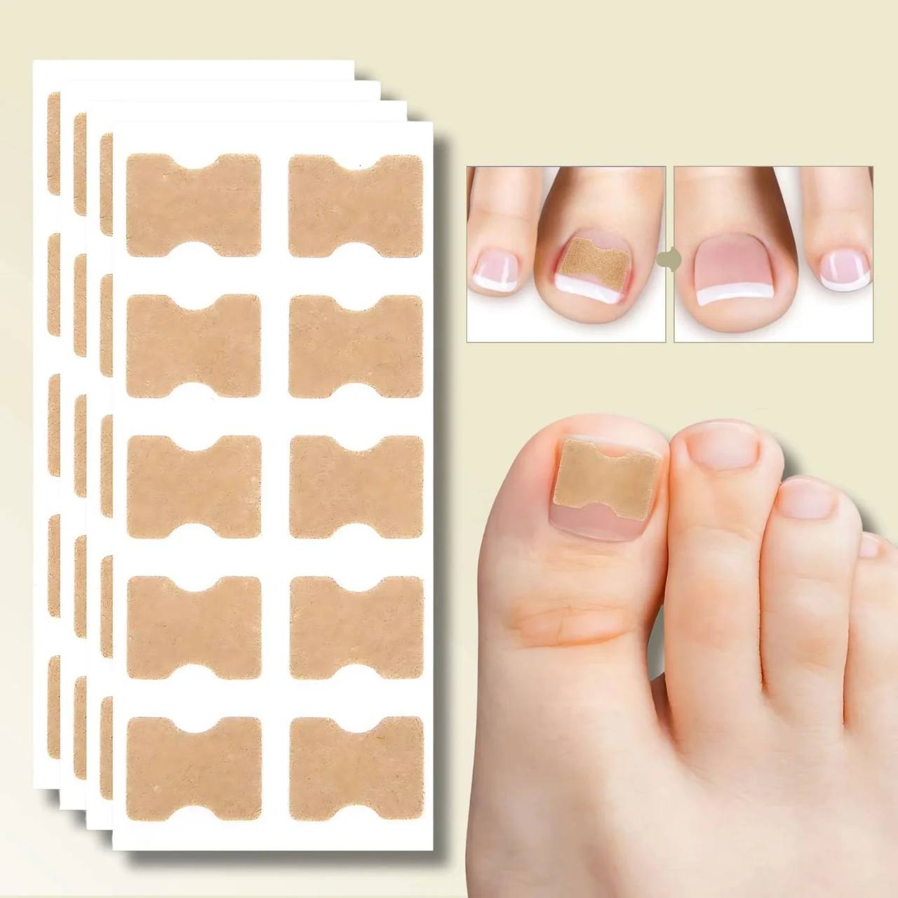 Instant Nail Repair Corrector for Ingrown and Damaged Nails