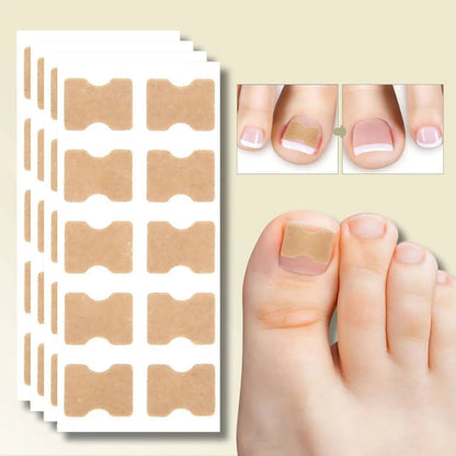 Instant Nail Repair Corrector for Ingrown and Damaged Nails