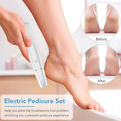 Electric Foot Callus Remover with LED Light and Adjustable Speeds