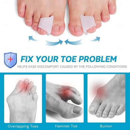 Silicone Toe Spacers with Loop Design, Reusable 6 Pack for Daily Comfort